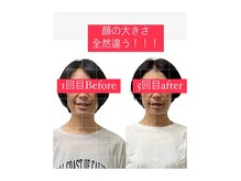 美容整体／全身骨格調整で私史上1番の小顔へ！