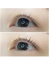 アイラッシュサロン フルール(eyelash salon FLEUR)/まつ毛美容液にブラックカラー