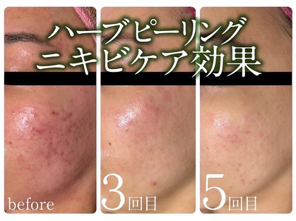 スイ 昭島店(Sui)の写真