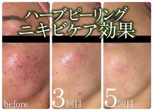 スイ 昭島店(Sui)