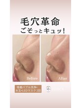 ジヒカ(ZIHICA)/【毛穴徹底洗浄★】