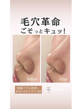 ジヒカ(ZIHICA)/【毛穴徹底洗浄★】