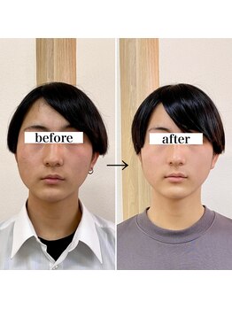 横浜DRT矯正院/小顔・美顔矯正