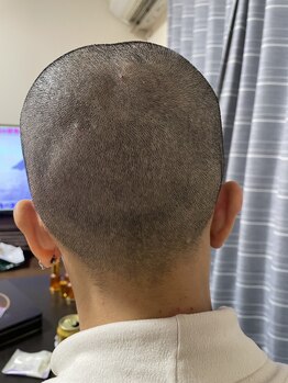 極めリラクゼーション/完璧な浮腫み除去骨まで見えます