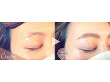 ソフィア(SOPHIA)/自分で処理していますか？