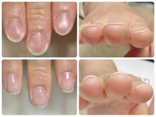 フェミニンネイル(Feminine Nail)の雰囲気（話題の自爪育成導入サロン◎短い爪/深爪/噛み爪/幅広爪もお任せ）