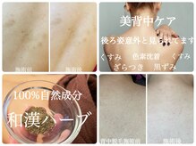 フォーチューンの雰囲気（背中ハーブ/小顔/脱毛/HBLまつ毛パーマ/よもぎ蒸し）