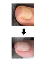 ホホホ(hohoho)/足爪ケア