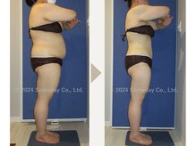 【3か月間の結果】　体重▲12.6kg 体脂肪▲12.2kg ウエスト▲18cm　下腹部▲16cm 太もも▲7.3cm