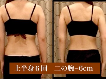 サロン セドナ(SALON SEDONA)/上半身リンパ痩身 6回コース