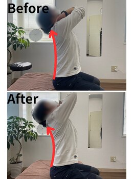 リライフ/Before/After