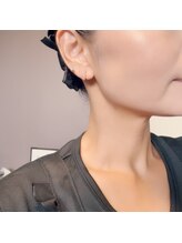 アウラ(AURA)/肌改善フルコースしました！