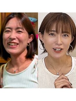 ゆう/まるごとリセット