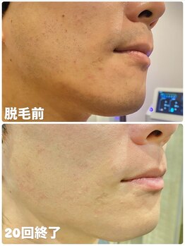 ワイズサロン(Y's salon)/別アングルです！