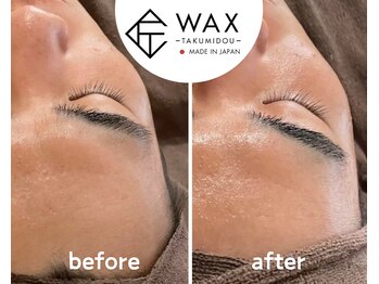 シエルエトワール 唐津店(Ciel Etoile)/匠道眉毛(アイブロウ)脱毛