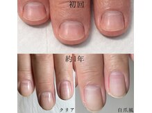 イズム(Izm)の雰囲気（メンズ爪改善。深爪・噛み爪で悩む男性も通われてます。）