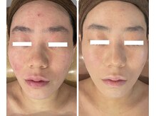 オレアグリーン 岡崎(OLEA green)の雰囲気（肌も小顔も育てて行きましょう♪小顔/岡崎/毛穴/エステ/ハーブ）