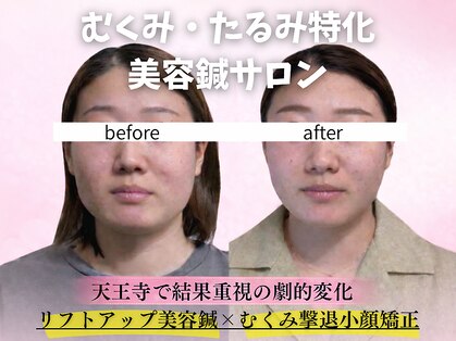 シャルム(CHARMEB)の写真