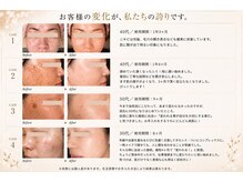 ノンノン(NonNon)の雰囲気(自宅ケアのみでシミ卒業シミを作るのも取れるのも肌の仕組から)