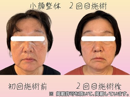 心晴。(コハル)の写真