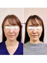 横浜DRT矯正院/小顔・美顔矯正