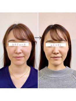 横浜DRT矯正院/小顔・美顔矯正