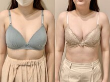 ティアモ(Ti Amo)/Before/After