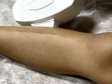 ベル(Belle+vi)/自信を持って肌見せ♪足脱毛