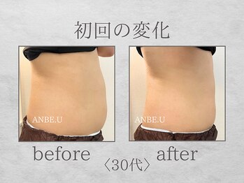 アンビーユー(ANBE.U)/腸もみビフォーアフター