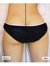 テラピ 藤江店/ハンド＆マシンで効果出し◎