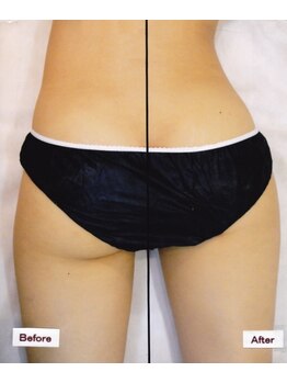 テラピ 藤江店/ハンド＆マシンで効果出し◎