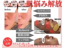 ティパニボーテ(Tipani Beaute')