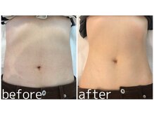 ラグーン(Lagoon)/WNBACK×筋膜リリース