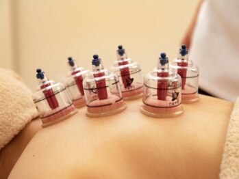 ルポ 那覇(repos)の写真/【身体ケア当店人気No1】本格鍼灸でつらい痛み・不調・腰痛・首肩コリを根本ケア◎