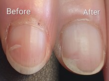 エンネイル(en.nail)/角質ケア