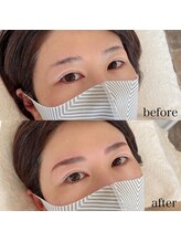 ダリ(Dali)/ハリウッドブロウリフト