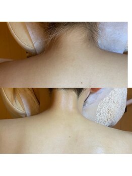 キラディ(KILADY)/後ろから見られても大丈夫！