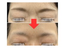 カラーリリー アンド ユン(Calla lily & yun)/シワ・たるみでお悩みの方に！