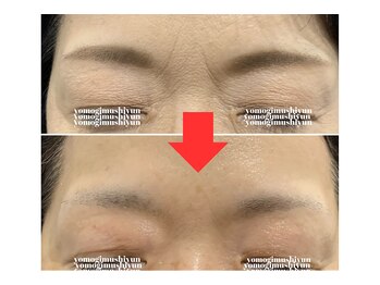 カラーリリー アンド ユン(Calla lily & yun)/シワ・たるみでお悩みの方に！