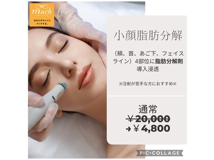 マッチ(much)の写真