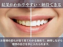 ホワイトニングサロン ホワイト 天童店(WHITE)/見てわかる効果を実感♪