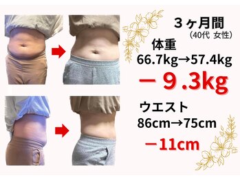 心穏はり灸 整体院/40代女性 Before&After