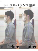 高座渋谷駅鍼灸院 整骨院/ 施術のbefore after