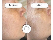 ユヌランコント 岐阜店(Une rencontre)/ララピール