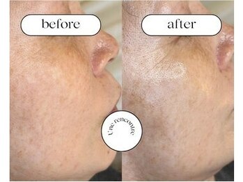 ユヌランコント 岐阜店(Une rencontre)/ララピール