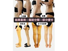レアティ(Leathy)の雰囲気（最短1ヶ月で見た目変化♪二の腕/お腹/太もも/ふくらはぎ集中ケア）