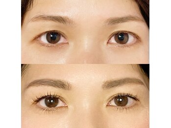 オメメ 八王子(omeme)/施術前（上）施術後（下）