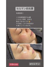 アンベール(unveil)/韓国エステ　セルマン