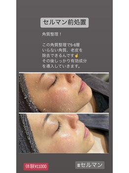 アンベール(unveil)/韓国エステ セルマン