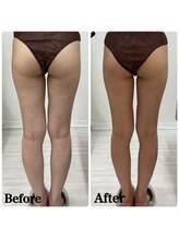 ルピア(L'pur)/下半身痩身★